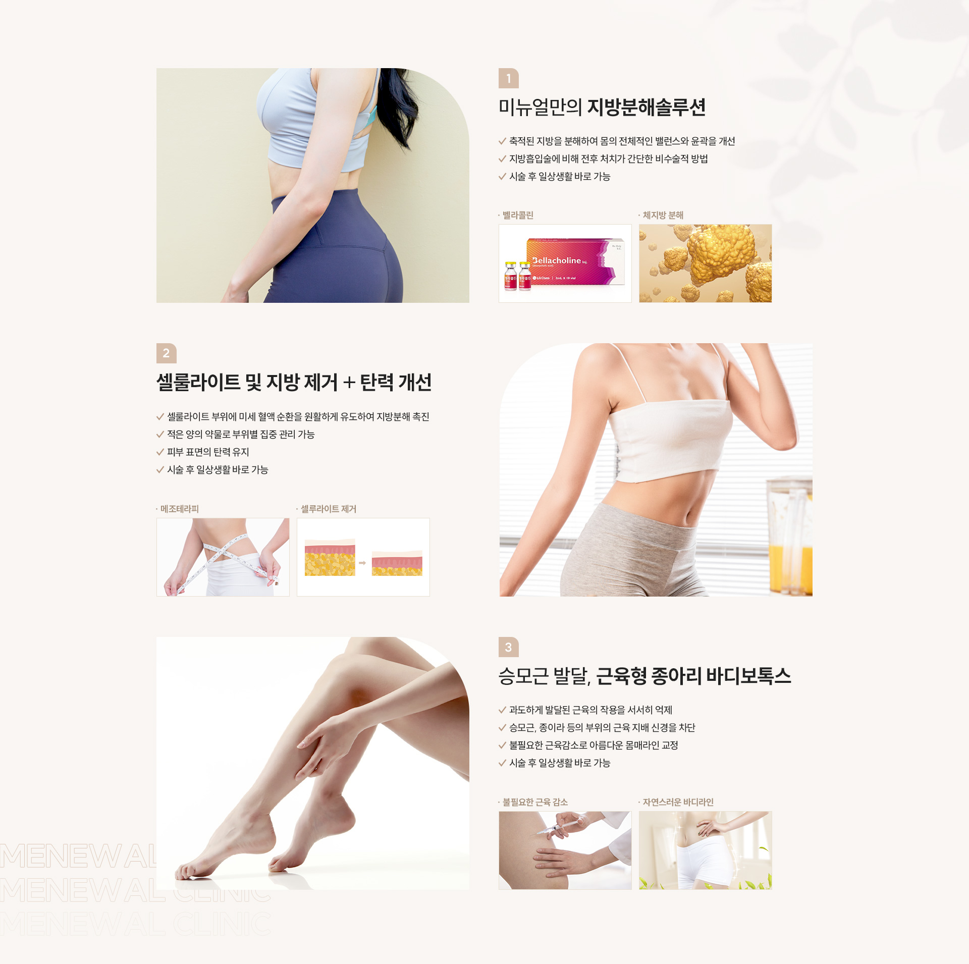 바디윤곽프로그램 장점
